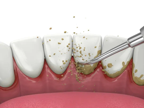 istockphoto-1419552740-612x612